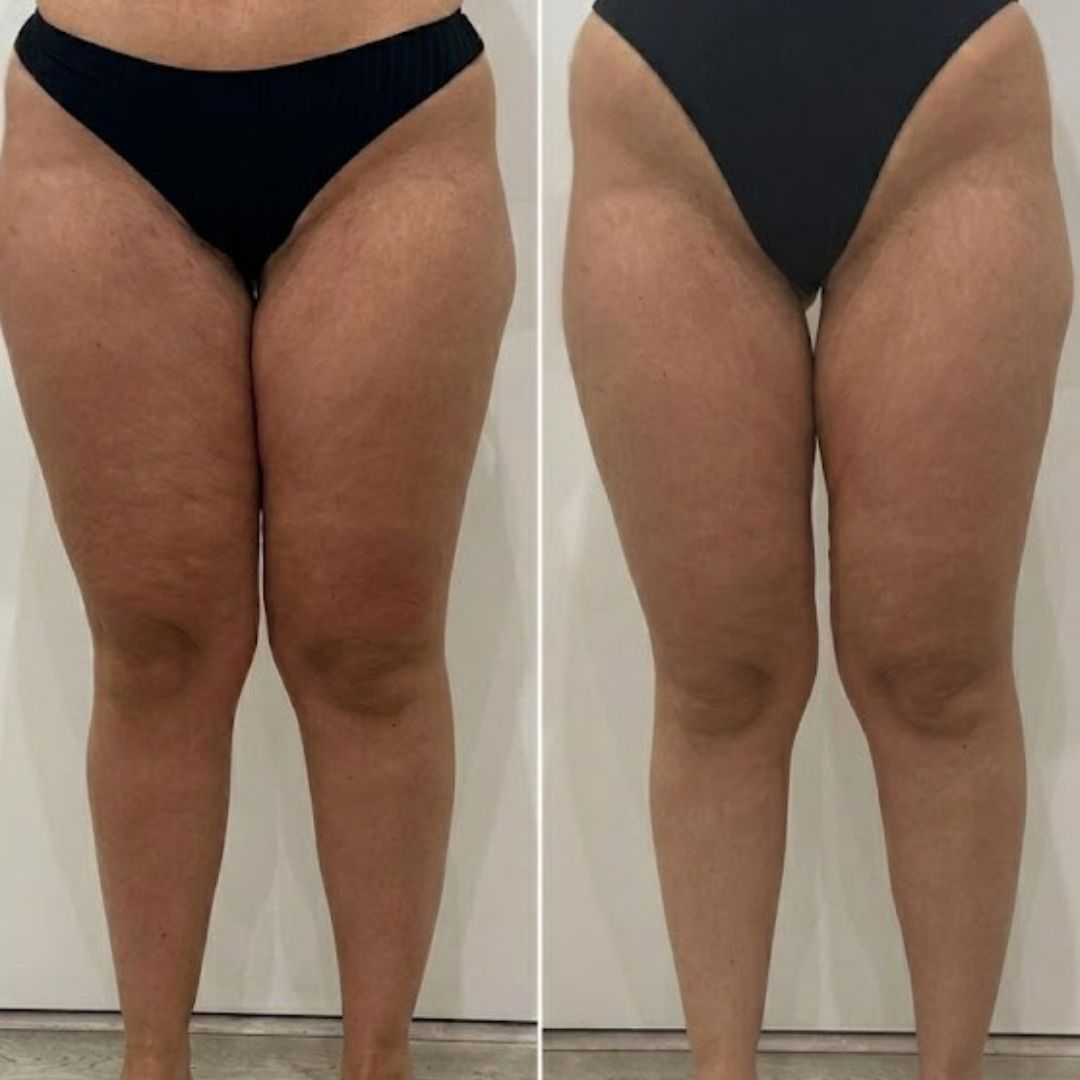 Transformación de Valentina